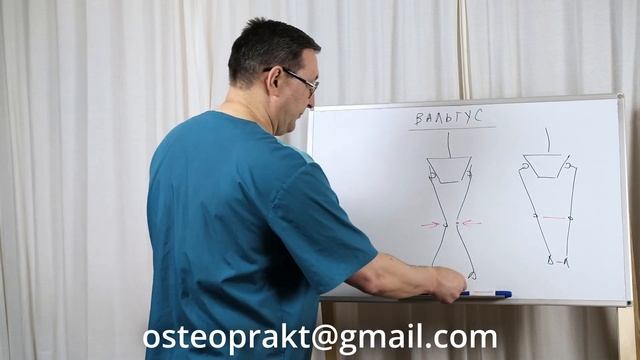 Вальгус Причины Фрагмент видеокурса смотреть онлайн