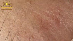 Most Satisfying and Relaxation with An Spa Video #188