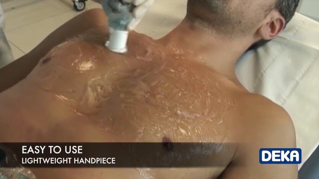 DEKA MOVEO technology: a new laser hair removal concept! смотреть онлайн