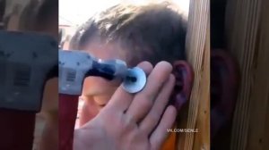 Прокололи ухо гвоздем