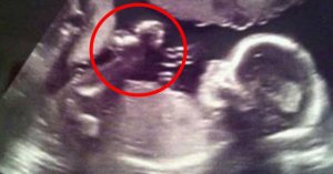 АНГЕЛ ПРОЯВИЛСЯ НА УЗИ !