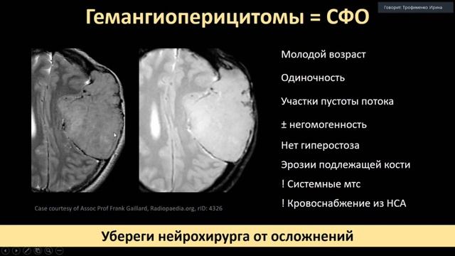 Трофименко И.А Внемозговые образования: как подойти к дифференциальному диагнозу