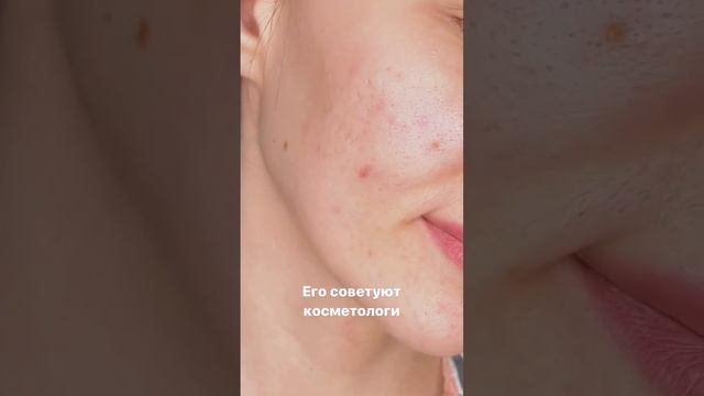 ЭНЗИМНАЯ ПУДРА ТВОРИТ С КОЖЕЙ ЧУДЕСА смотреть онлайн