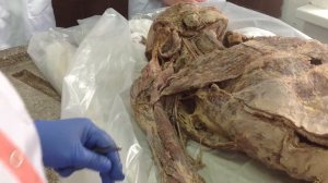 Кровеносная система анатомия