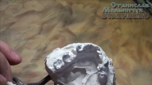 Прикусные шаблоны для последующей обточки и моделировки зубов при сложных или заниженных прикусах