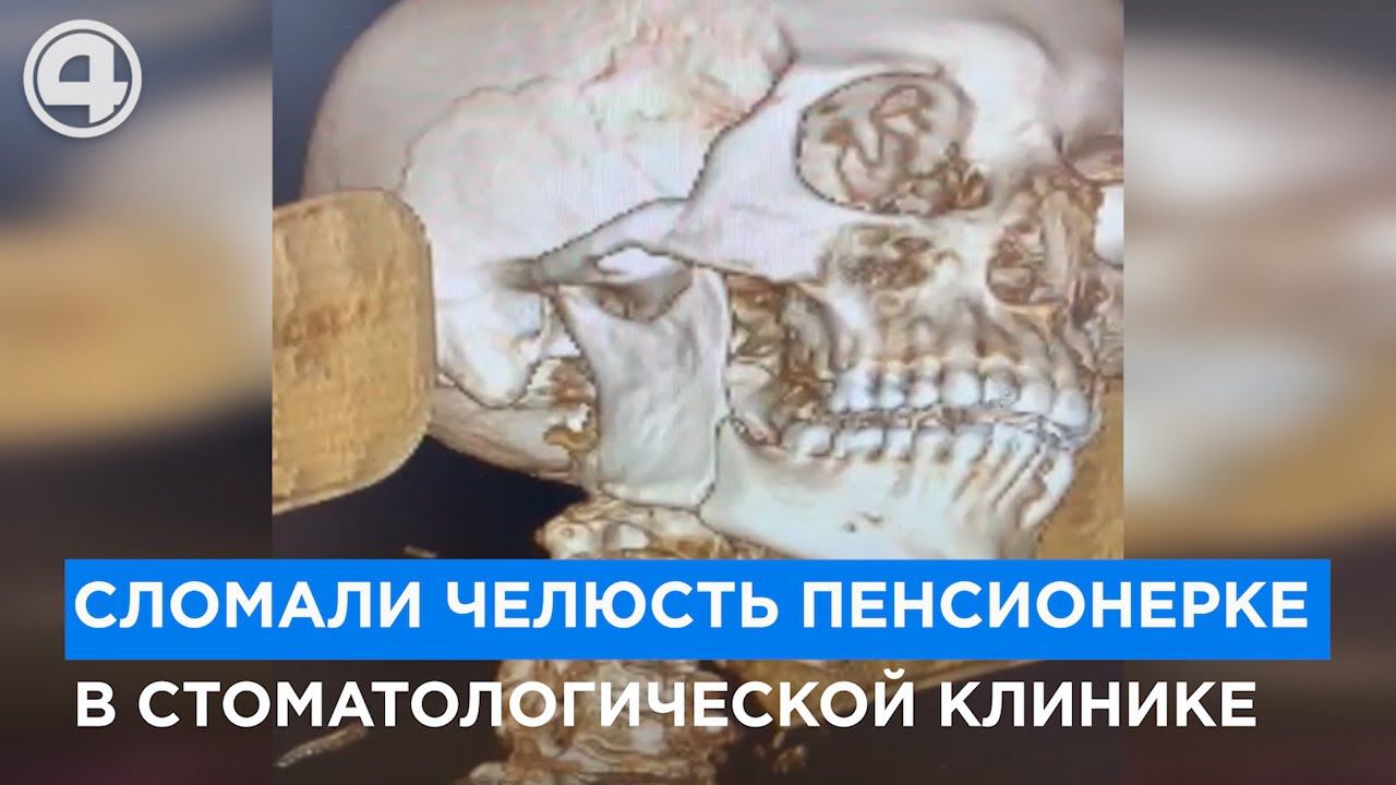 Пенсионерке сломали челюсть в стоматологии