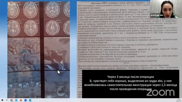 Клинический случай: Резистентная пролактин-секретирующая макроаденома гипофиза и ожирение