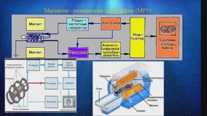 Магнитно-резонансная томография (МРТ)
