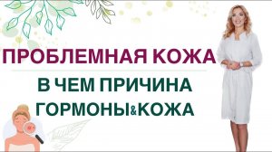 ❤️ ПРОБЛЕМЫ С КОЖЕЙ, В ЧЕМ ПРИЧИНА❓ГОРМОНЫ, ПИТАНИЕ И КОЖА Врач эндокринолог, диетолог Ольга Павлова