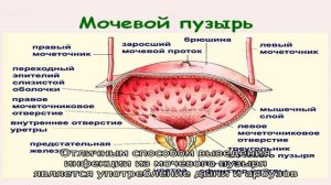 Инфекции мочевого пузыря
