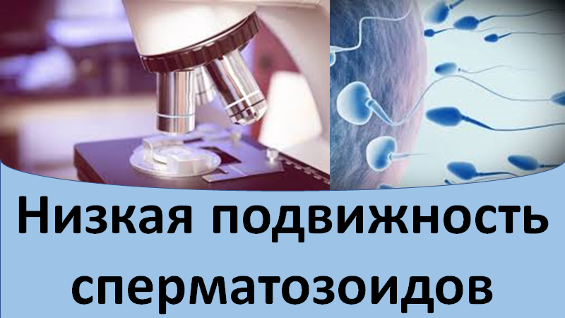Низкая подвижность сперматозоидов