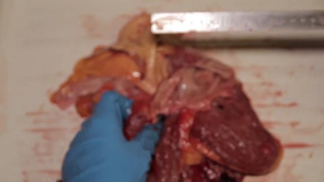 Раздельное взвешивание и измерение основных морфометрических показателей сердца человека.