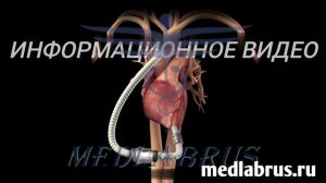 Лечение сердечной недостаточности - хирургические процедуры