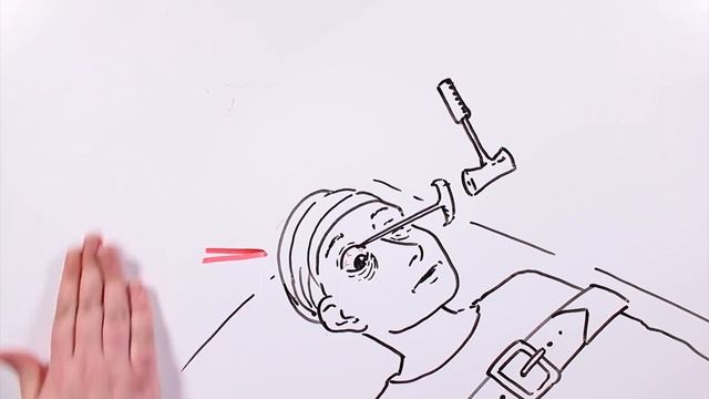 LOBOTOMÍA ?? | Draw My Life смотреть онлайн