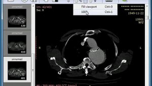Функции программы для просмотра МРТ снимков Radiant DICOM Viewer