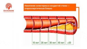 Система микроциркуляции. Препараты M.A.I.N от Ангиофарм.