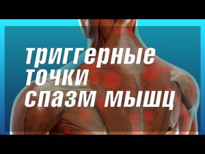Тригерные точки проблему которые многие не знают - миофасциальный синдром