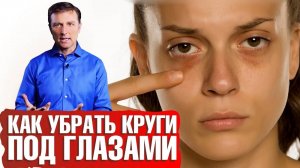 Темные круги под глазами: как избавиться? Почему появляются синяки под глазами? 📣