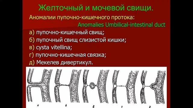 Лекция. Хирургическая анатомия переднебоковой стенки живота  Грыжи. Грыжесечение.