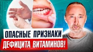 Явные признаки и все причины дефицита витаминов А, В, С, Д, Е, К...