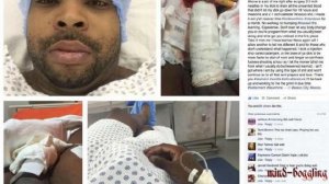 5 Most Bizarre Injuries of Pornstar Ever Recorded