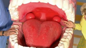 Жить здорово! Выпуск от 10.09.2013