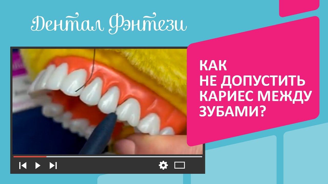   Как не допустить кариес между зубами?