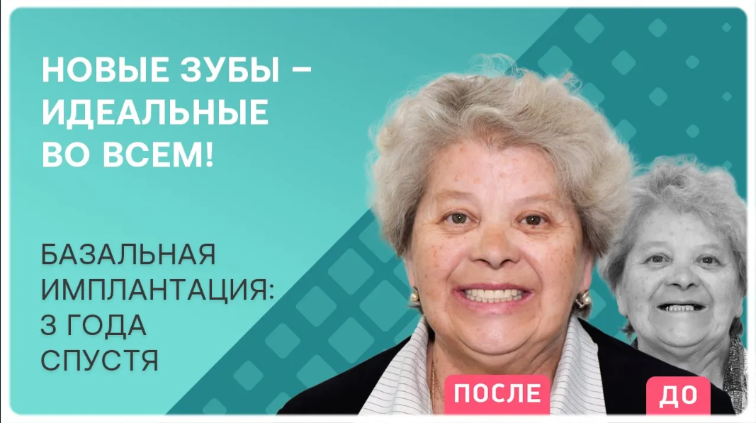 Институт базальной имплантации в москве адрес. Институт базальной имплантации в москве адрес. Институт базальной имплантации лого. Базальная имплантация отзывы пациентов. Институт базальной имплантации в москве отзывы.