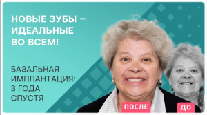 Базальная имплантация всех зубов ? отзыв через 3 года