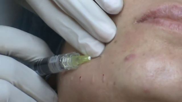 Не могу, папулы маленькие :\ Так к этому все стремятся! :) смотреть онлайн