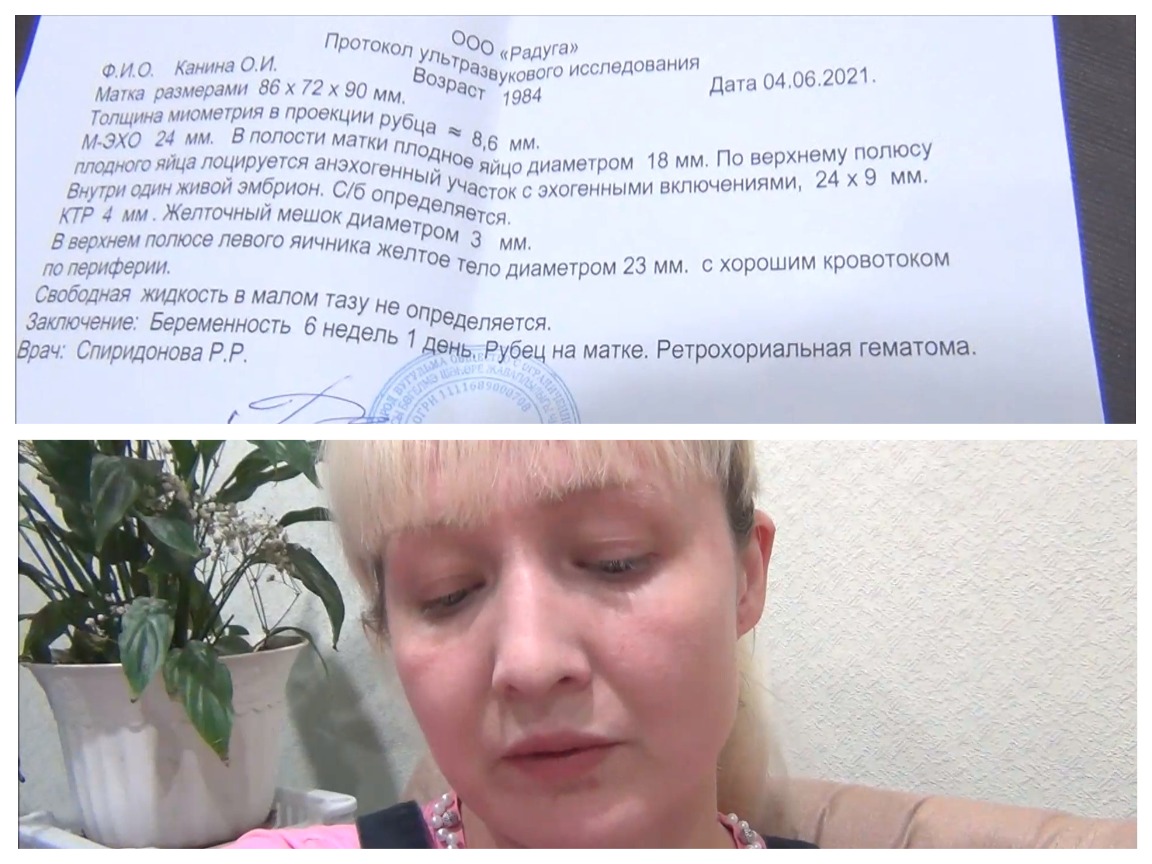 Я БЕРЕМЕННА? ДОПРЫГАЛАСЬ? БЕРЕМЕННОСТЬ ПОД УГРОЗОЙ?