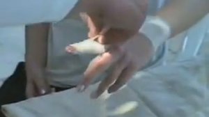 Десмургия - Повязка на второй палец кисти