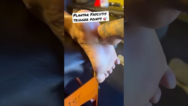 NO MORE Plantar fasciitis, TriggerPoints for Foot Pain ?? #footpain #plantarfasciitis