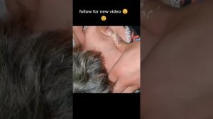 Самое залипательное видео давить прыщи Черные точки