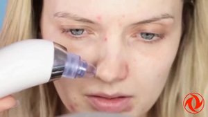 Портативный вакуумный очиститель пор лица кожи и прибор для пилинга чистки удаление черных точек
