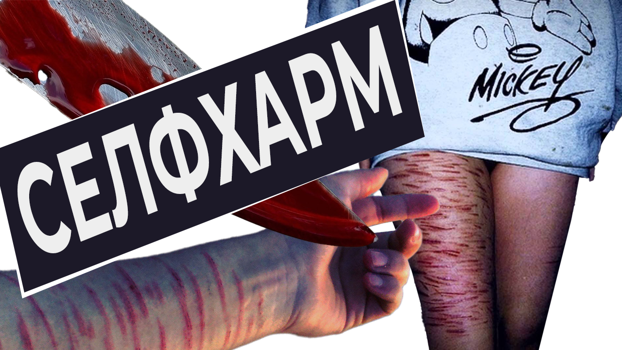 селфхарм self-harm самоповреждение повреждение тела выявление причин психотерапия лечение