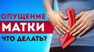 Опущение матки — от причин до методов лечения! / 5 основных упражнений для мышц тазового дна!