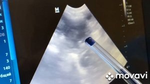 Узи самки кролика