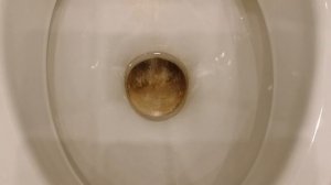 Как очистить унитаз от мочевого камня и известкового налета