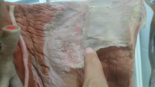 Male Inguinal 02