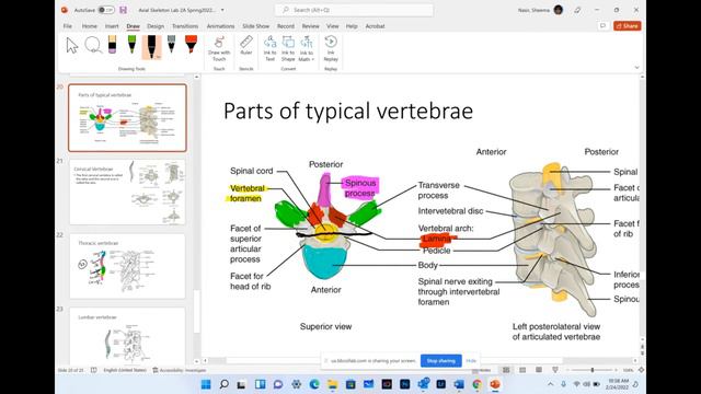 Axial Skeleton - Part 3 - (Sternum, Ribs, Vertebrae) смотреть онлайн