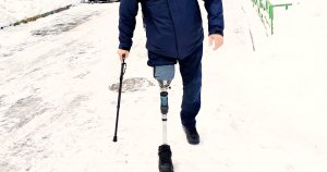 Коленный модуль "NK6 “Symphony" - рассказ пользователя протезов.