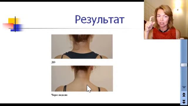 Как избавиться от морщин / Елена Бахтина #спросиэксперта смотреть онлайн