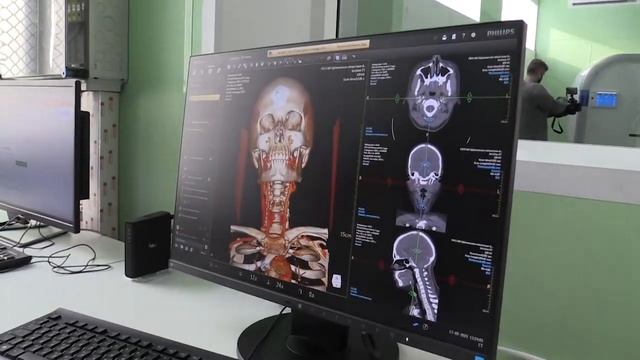 Современный аппарат для КТ в Щёлково смотреть онлайн