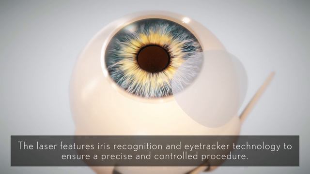 +Me treatment with LASIK Technique смотреть онлайн