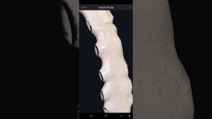 РЕБЕРНО-ГРУДИННЫЕ СУСТАВЫ