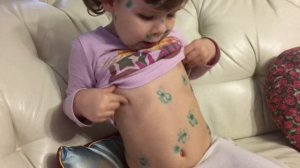 Ребенок рассказывает, что такое ВЕТРЯНКА