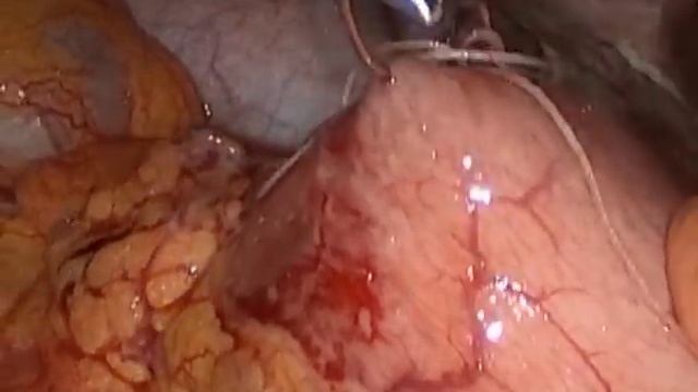 fishbone (рыбья кость) смотреть онлайн