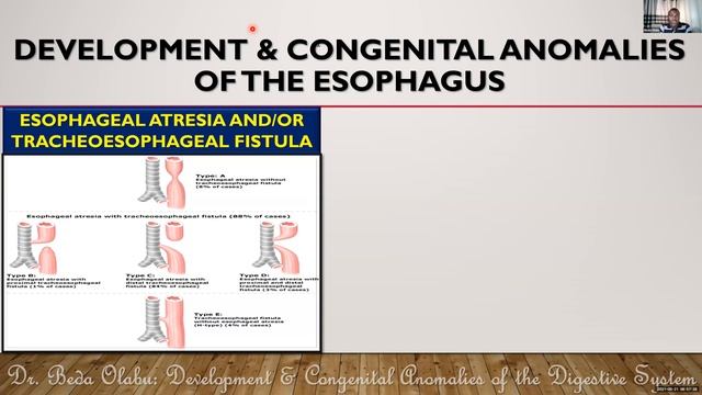 DIGESTIVE SYSTEM DEVELOPMENT PART I - DEVELOPMENT & ANOMALIES OF THE HOLLOW GIT смотреть онлайн