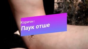 САМЫЕ ОПАСНЫЕ И ЯДОВИТЫЕ ПАУКИ В МИРЕ